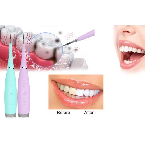 Ultrahangos fogtisztító - A bátor és önfeledt mosolyért!